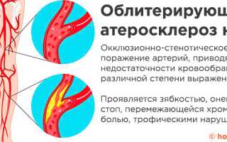 Оаснк код мкб 10