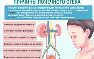 Лечение отечного синдрома при хпн