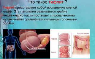 Воспаление слепой кишки код по мкб