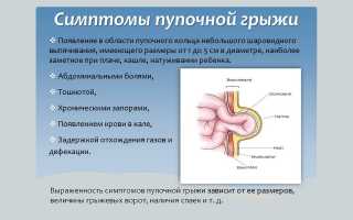 Код мкб ущемленная пупочная грыжа