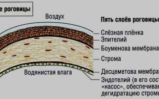 Бельмо на глазу код мкб