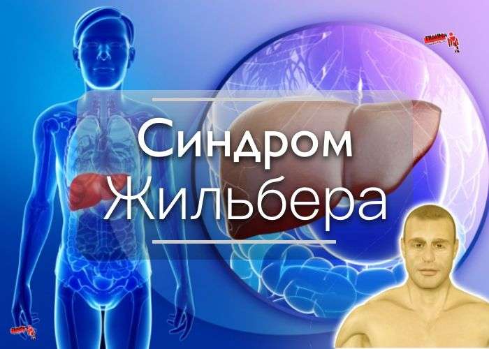 Синдром Жильбера: причины, симптомы, диагностика, лечение