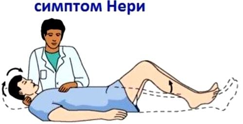 Остеохондроз с корешковым синдромом упражнения